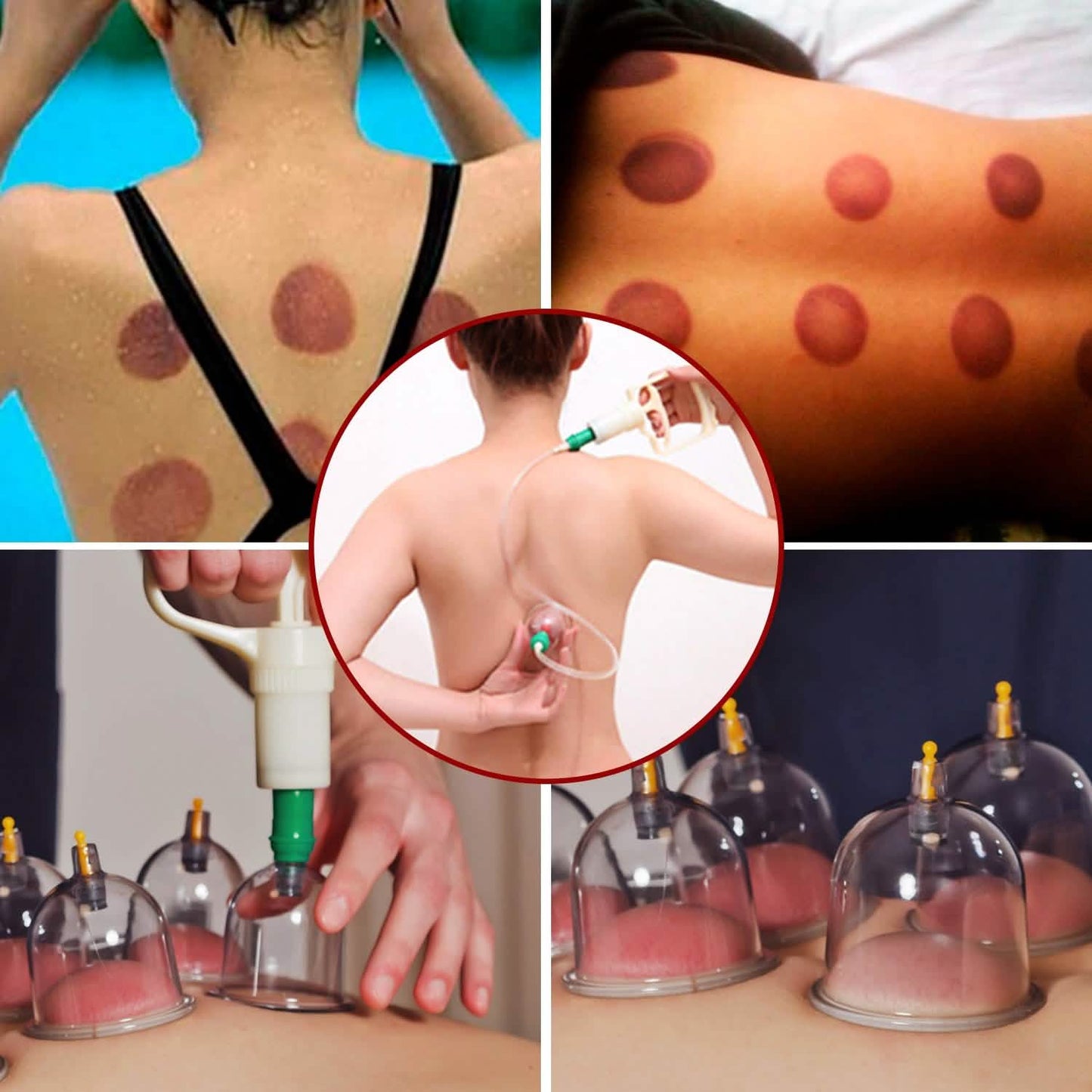 32-teiliges chinesisches Schröpfkopf-Therapie-Set
