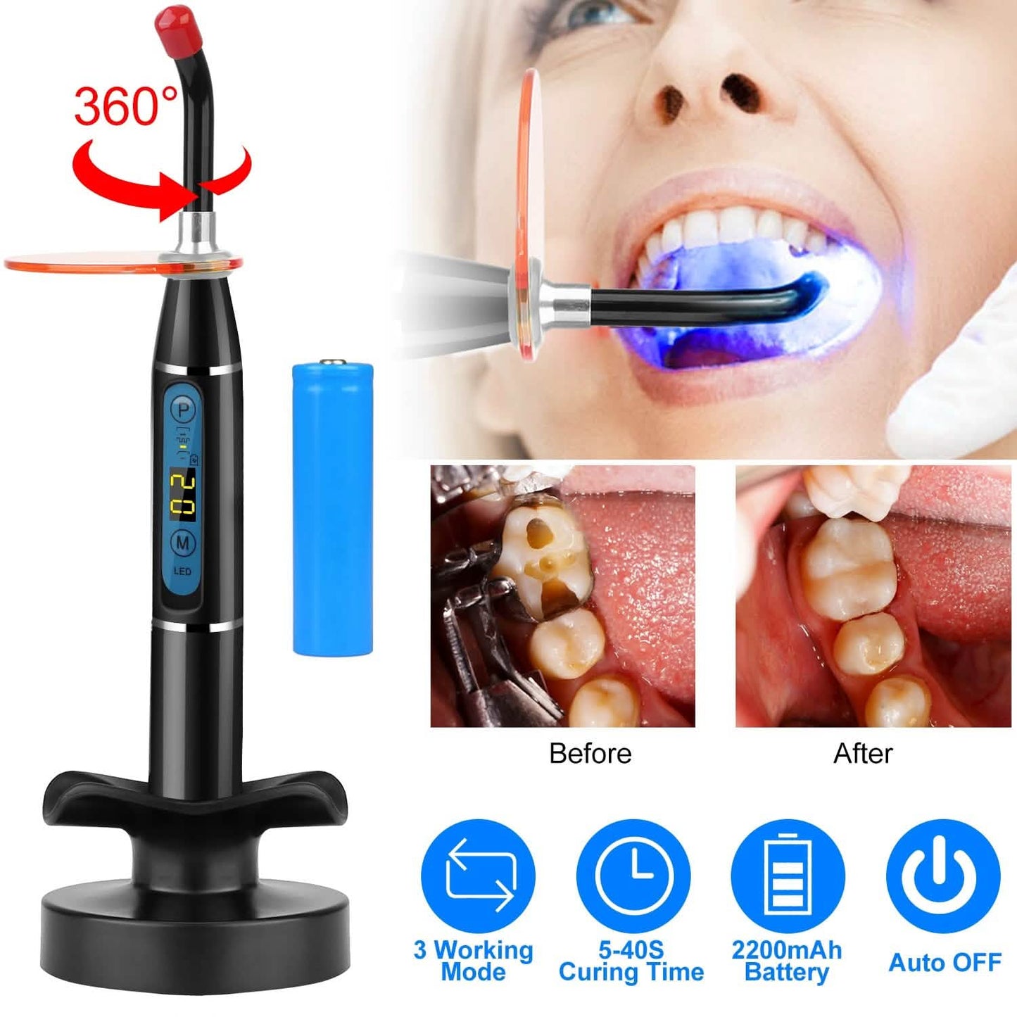 5W Kabellose Dental-LED-Polymerisationslampe