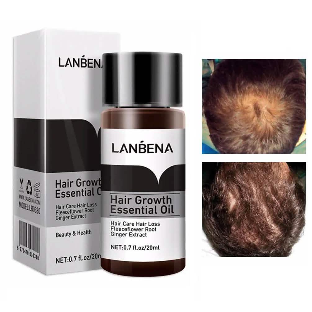 Ätherisches Öl für Haarwachstum und Haarausfallbehandlung für Männer und Frauen