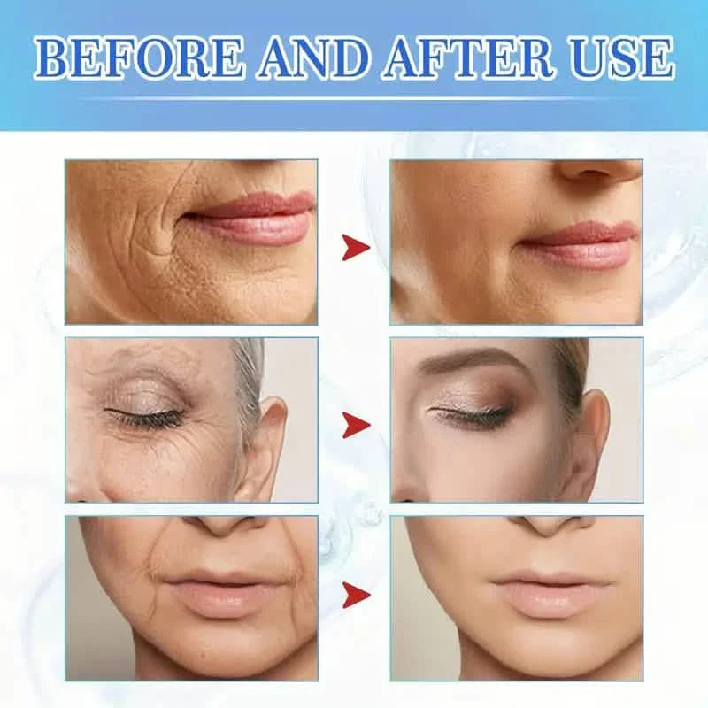Intensives Anti-Aging Botox Gesichts-Serum – Kollagen-Serum für die Haut mit Vitamin C, Hyaluronsäure und Niacinamid