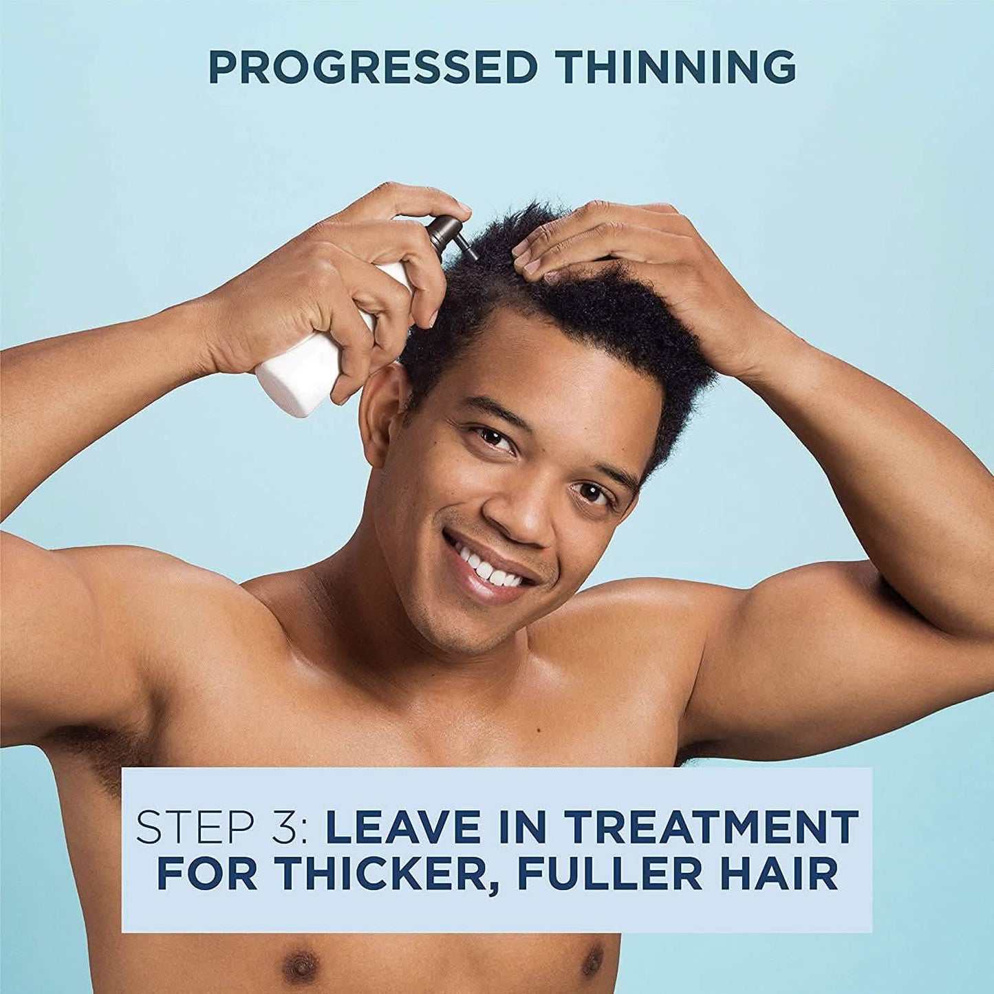 Nioxin Full-Size System Kits für fortschreitende bis fortgeschrittene Haarausdünnung