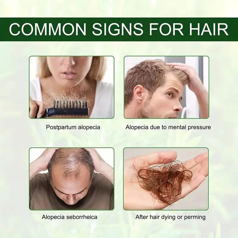 Rosmarinöl für Haarpflege, Kopfhautmassage, Hautpflege und Aromatherapie