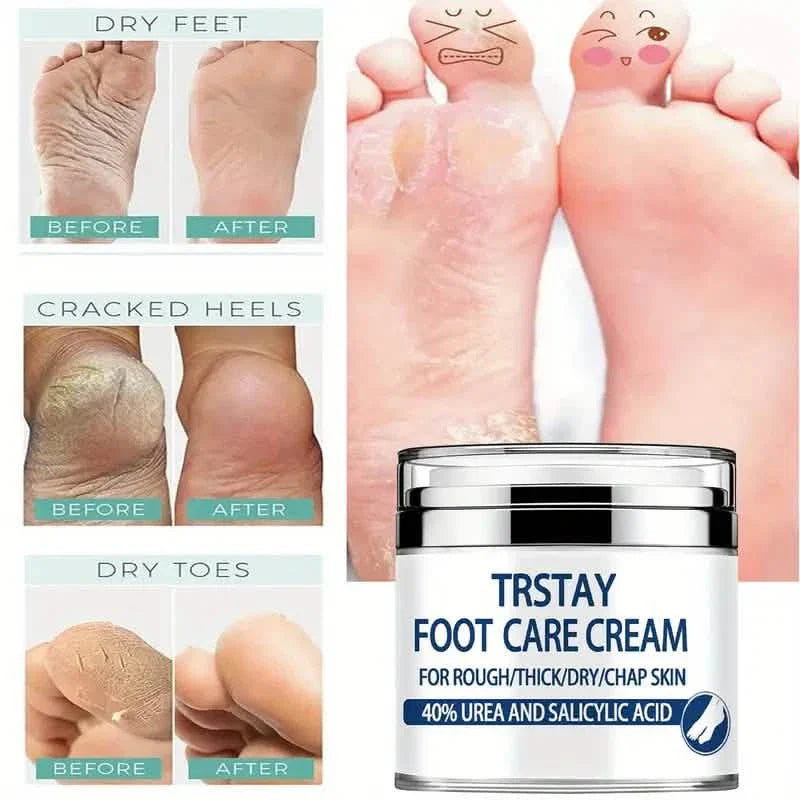Trstay Fußpflegecreme 50g / Fußcreme 40% Urea und Salicylsäure