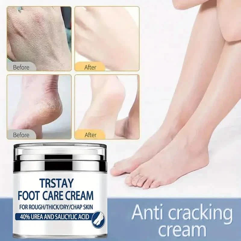 Trstay Fußpflegecreme 50g / Fußcreme 40% Urea und Salicylsäure