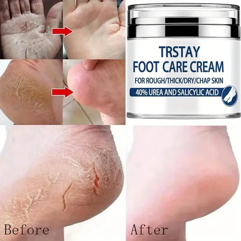 Trstay Fußpflegecreme 50g / Fußcreme 40% Urea und Salicylsäure